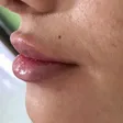 مرکز پوست و لیزر آویژه
