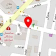 شنوایی سنجی طنین