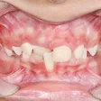 فتوگرافی پزشکی طب نگار