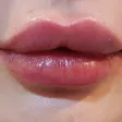 کلینیک پوست و مو گلسان