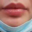 کلینیک پوست و مو گلسان