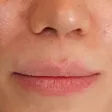 کلینیک زیبایی دکتر نادر یزدان پناه