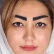 کلینیک کاشت مو زندیه