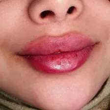 کلینیک زیبایی دکتر مصطفی کریمی