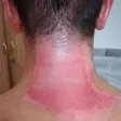 درمانگر زخم داود حسنلو