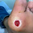 درمانگر زخم امیرمهدی نعمتی