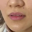کلینیک زیبایی هیوا