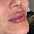 کلینیک زیبایی شاین اسکین