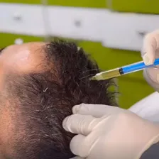 کلینیک زیبایی متیس