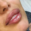 کلینیک زیبایی آرمیتا