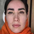 کلینیک زیبایی دکتر مهلا بلوچ