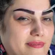 کارشناس کاشت مو فائزه نظامیوند