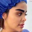 کلینیک کاشت مو غربی