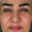 کارشناس کاشت مو شادی حسینی