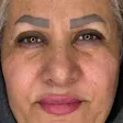 کارشناس کاشت مو شادی حسینی