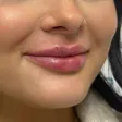 کلینیک زیبایی نکوئین